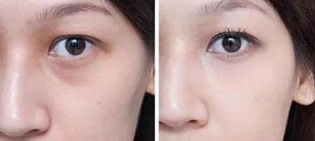 吃瓜眼睛累,揭秘网络时代视觉疲劳的真相