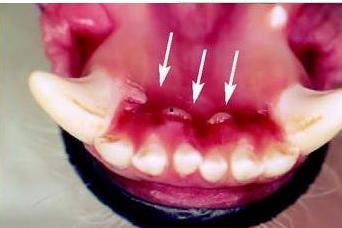 吃瓜牙龈都出血