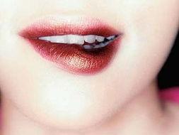 吃瓜牙龈都出血